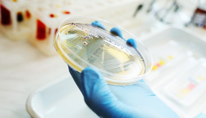 Bacillus cereus Count