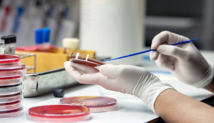 Determination of Bacterial Endotoxin (LAL) 