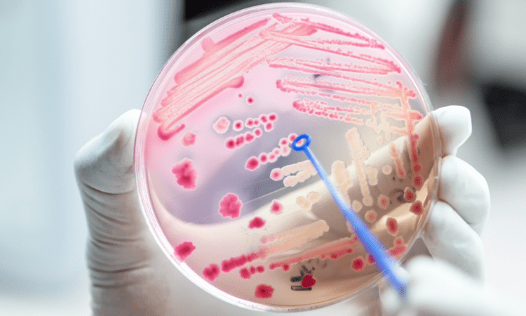 Análisis microbiológico de los alimentos: seguridad alimentaria