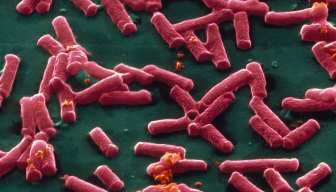 Clostridium perfringens enumeration: Food Microbiological