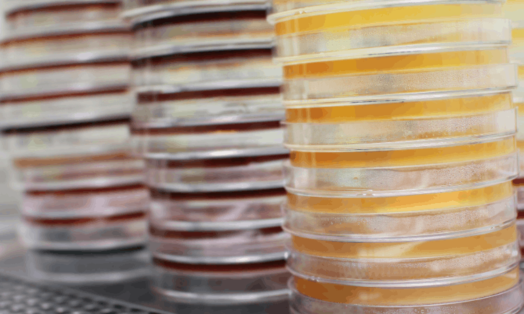 De la ferme au laboratoire : sécurité alimentaire et analyses microbiologiques