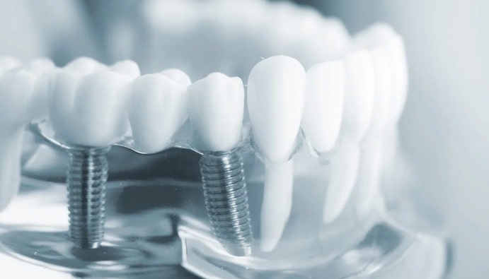İmplantasyon Testleri: Tıbbi Cihazların Doku Uyumluluğu