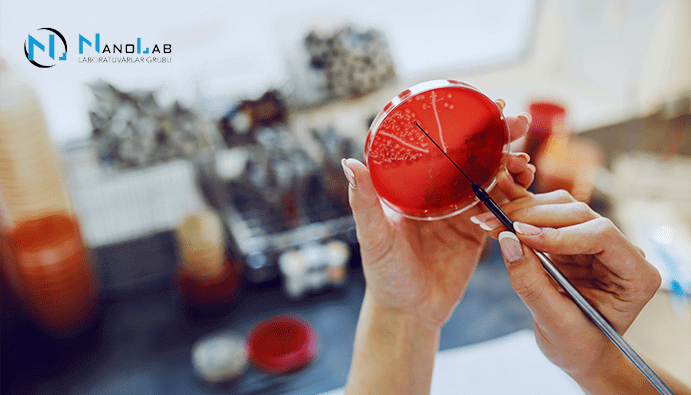 Mesophilic Aerobic Bacteria Count: Food Products