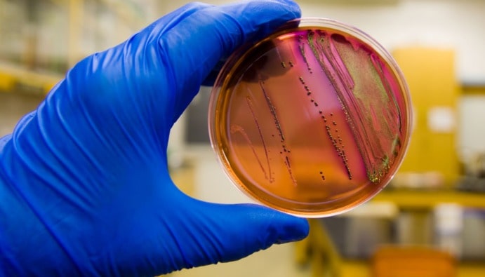 ISO 16654 - Escherichia coli O157 Aranması