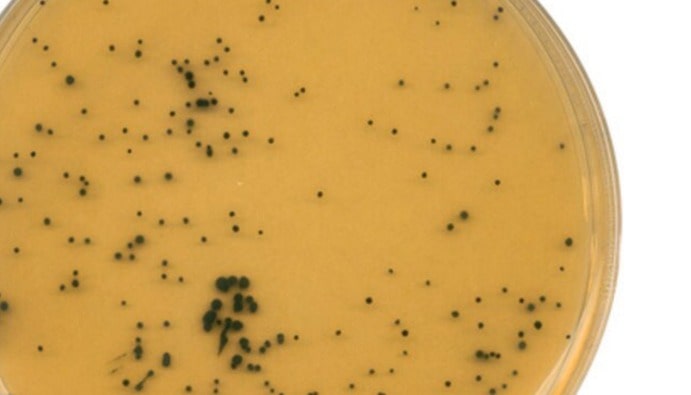 ISO 7937: Gıdalarda Clostridium perfringens Sayımı ve Analiz Yöntemleri