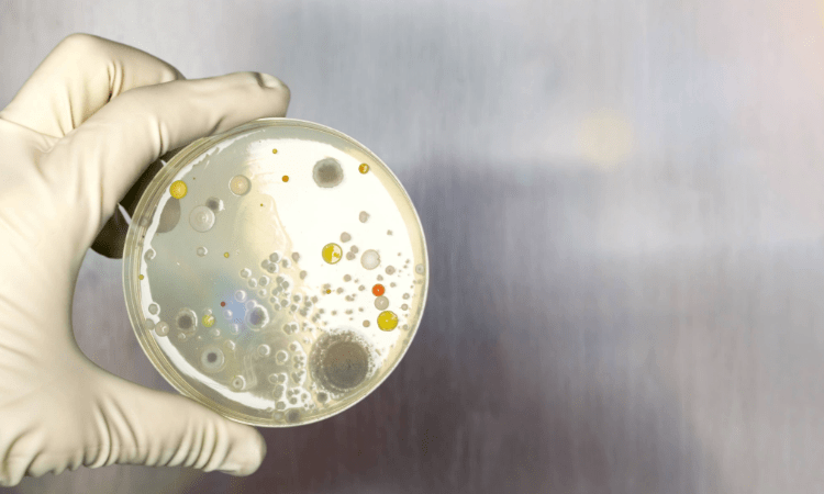 ¿Qué es el análisis microbiológico de alimentos? ¿Para qué sirve?