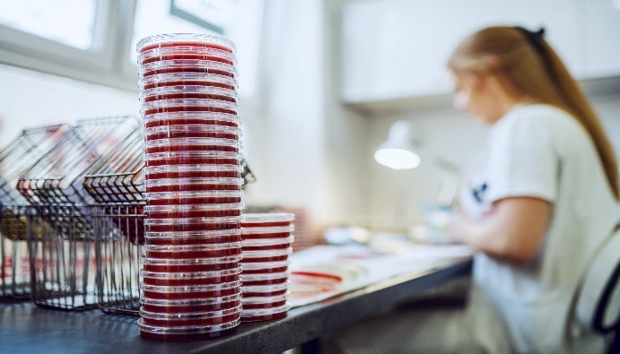 Vibrio Species Detection - Identification: Microbiological